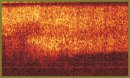 Confocal Microscopy and Optical Coherent Tomography for Evaluation of the Anatomical and Functional State of Corneal Wound (in vivo) after Cataract Phacoemulcification
