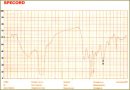 Chemical Composition Analysis of Gallstones in Patients with Cholelithiasis Using Infrared Spectrometry