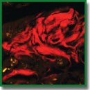 A Novel Method for Amyloid Detection in Human Tissue Load Using a Fluorescent Dye — Congo Red Analogue