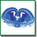 Identification of Novel Mutations Controlling Cerebral Cortex Malformations Caused by ENU-Induced Mutagenesis in the Mouse