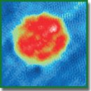 Alterations in the Phase Portrait and Electrophoretic Mobility of Erythrocytes in Various Diseases
