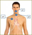 Computer-Assisted Assay of Respiratory Sounds of Children Suffering from Bronchial Asthma