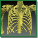 Surgical Treatment of Patients with Benign Tumors and Tumor-Like Diseases of Tubular Bones Using 3D Modeling and Computer Navigation