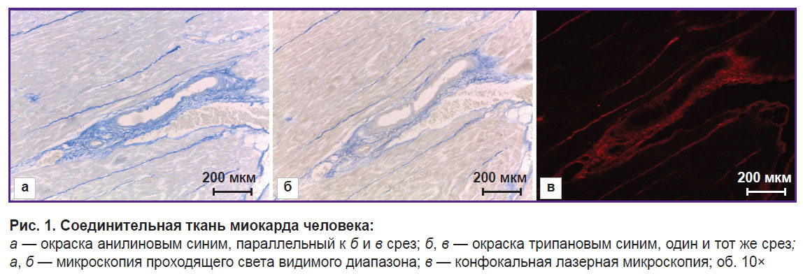 beketova-ris-1.jpg